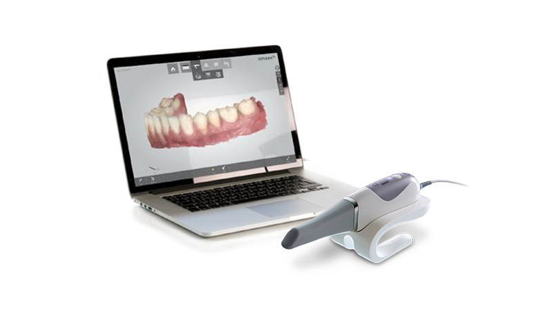 dental-scanner